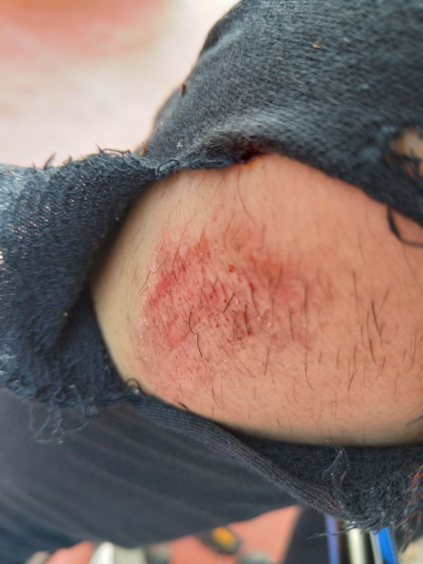 裤子破了,蓝牙耳机也摔坏了,幸亏戴了头盔,要不然头破血流.